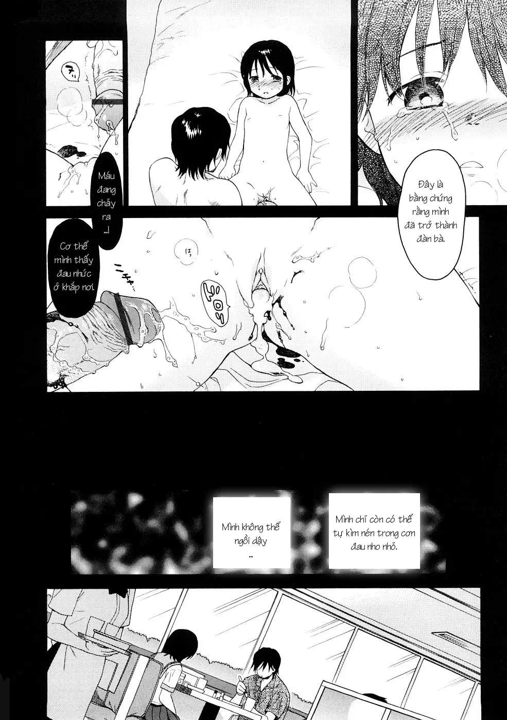 YOUR DOG Ch. 1-8 - YOUR DOG Ch. 1-8 trang 174